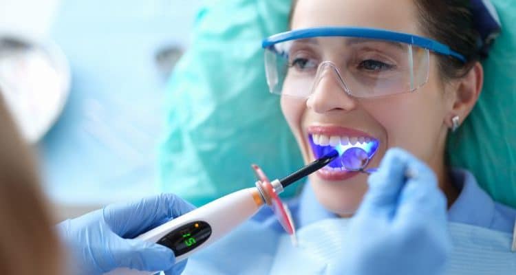 what are composite fillings and their benefits