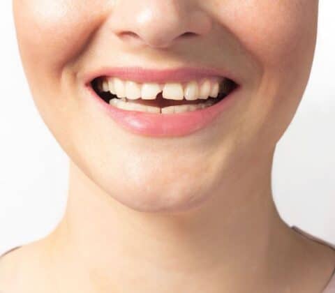 what are the best treatment options for a broken tooth